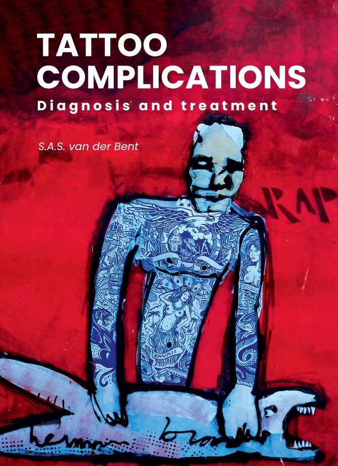 Tattoo complications, dissertatie Sebastiaan van der Bent